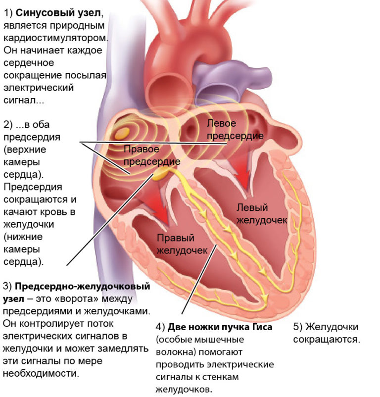 Мерцательная аритмия картинки