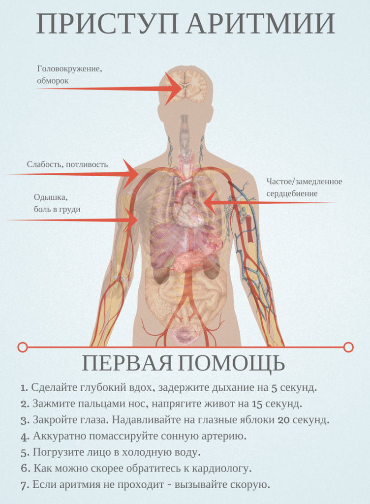 Лечение мерцательной аритмии: препараты при хронической форме, лечение ...