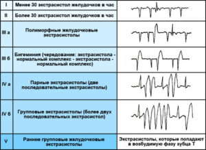 Проверка экг по фото